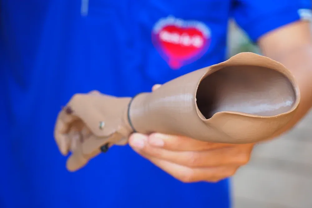 3D printed bcmf-gripper orthosis 3