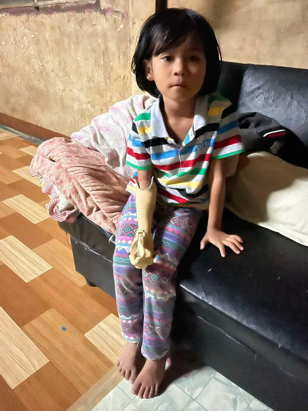 3D printed bcmf-gripper orthosis 6
