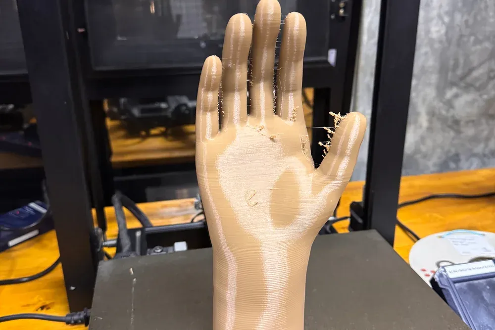 3D printed cosmetic-hand orthosis 1