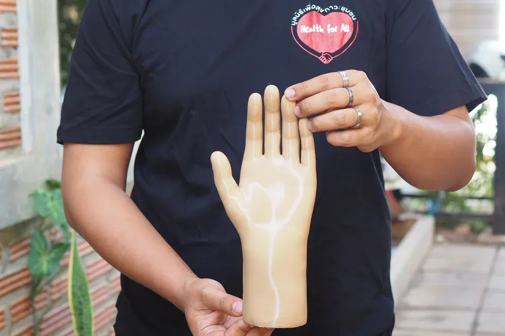 3D printed cosmetic-hand orthosis 6