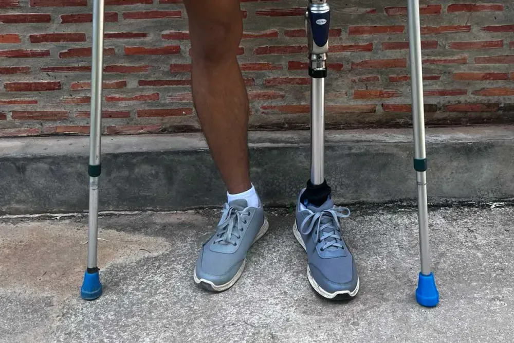 3D printed crutch-tip orthosis 5