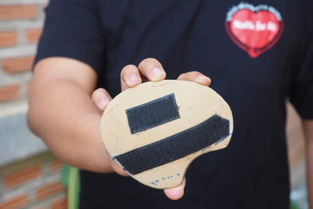3D printed external-cranial-plate orthosis 2