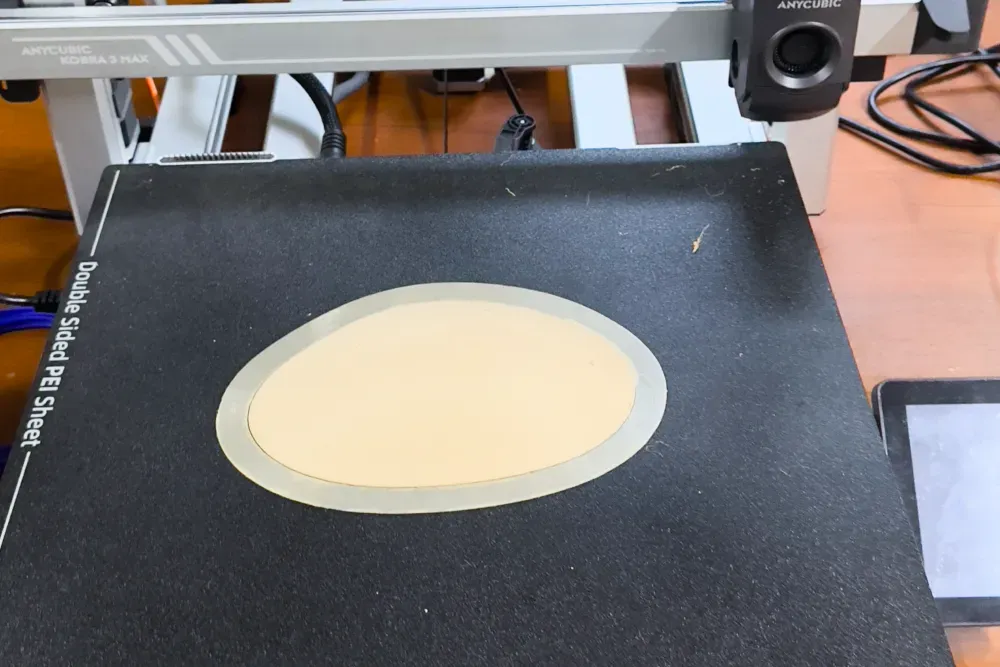 3D printed external-cranial-plate orthosis 4