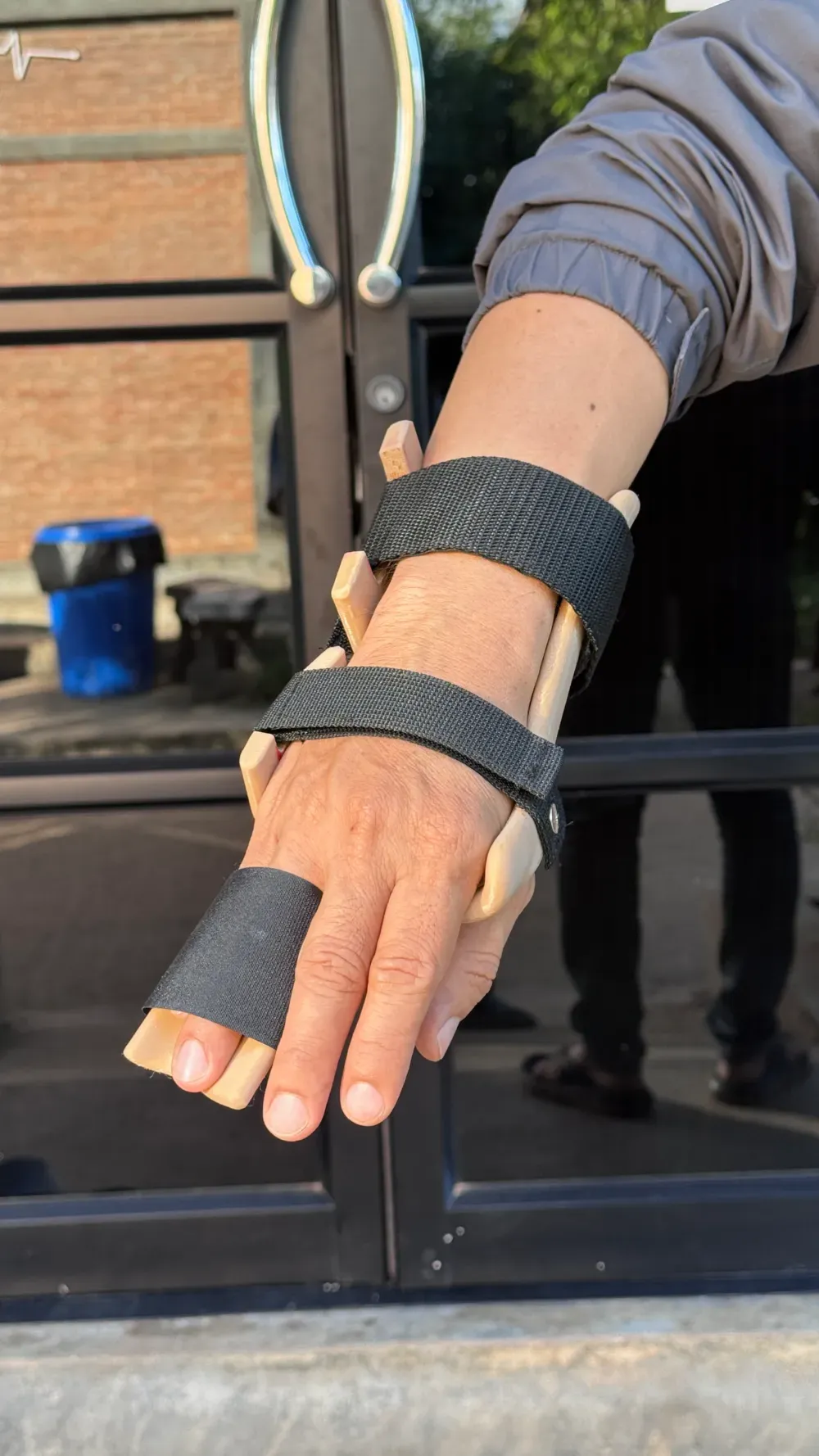 3D printed orthosis 2