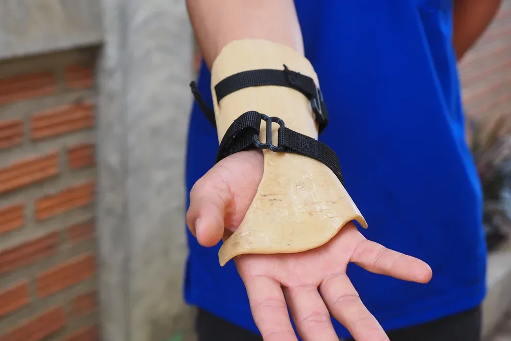3D printed orthosis 4