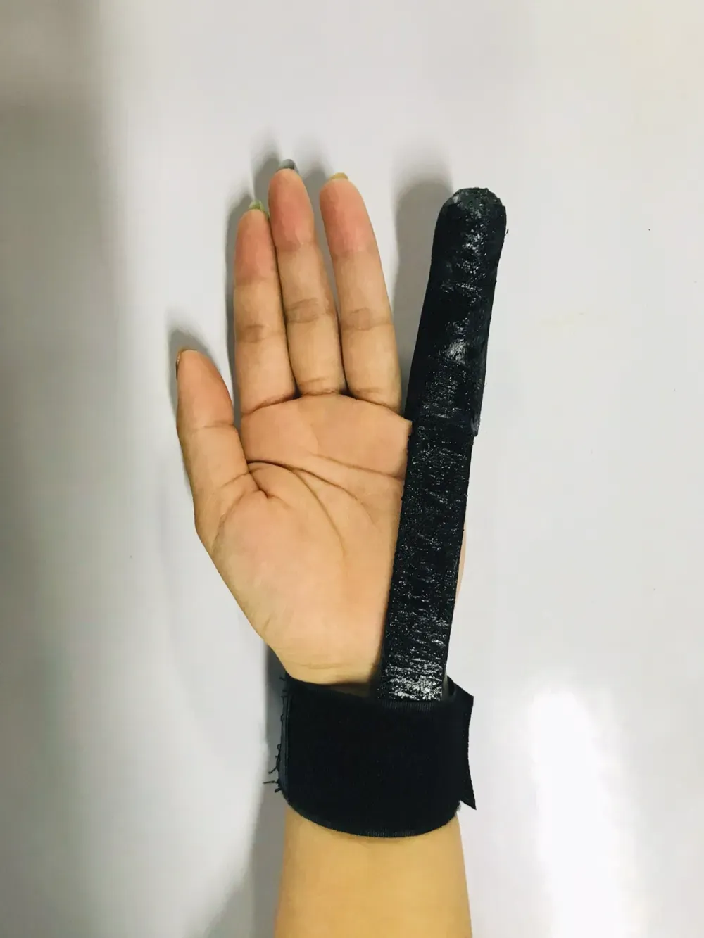 3D printed orthosis 7