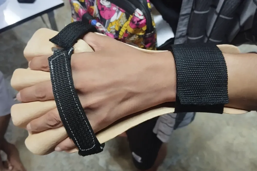 3D printed orthosis 8