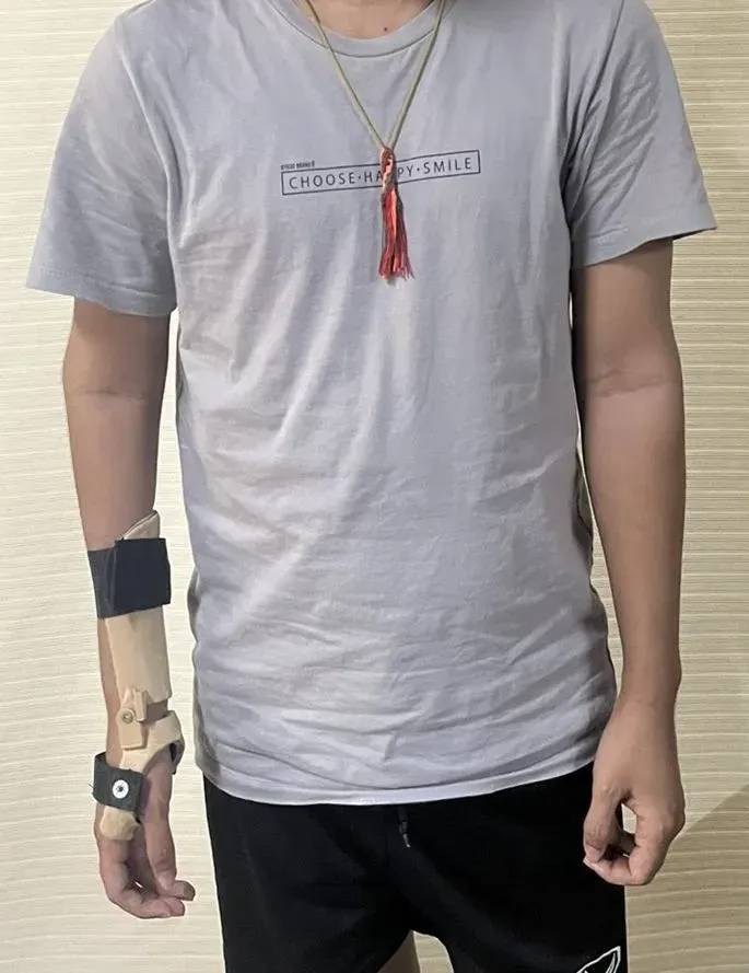 3D printed orthosis 9