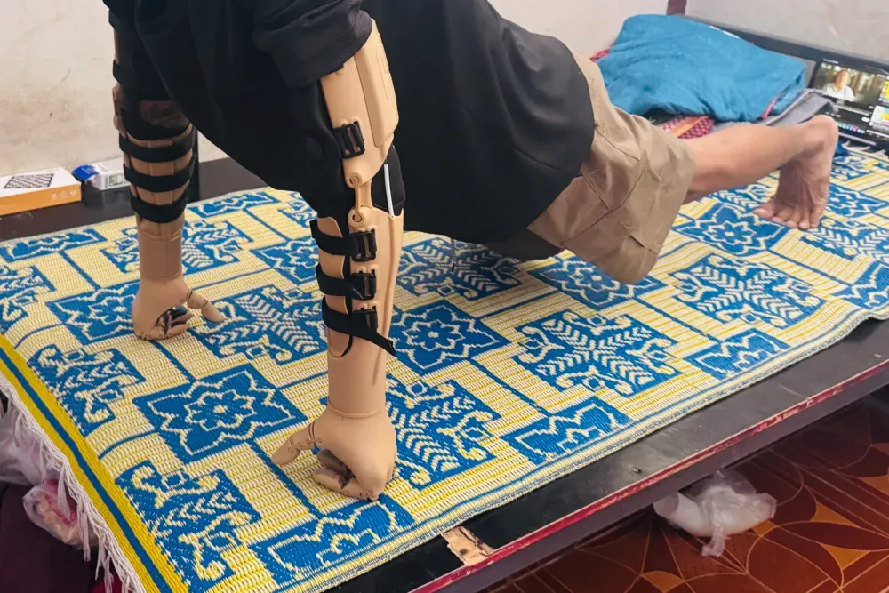 3D printed prosthetic-arm orthosis 7
