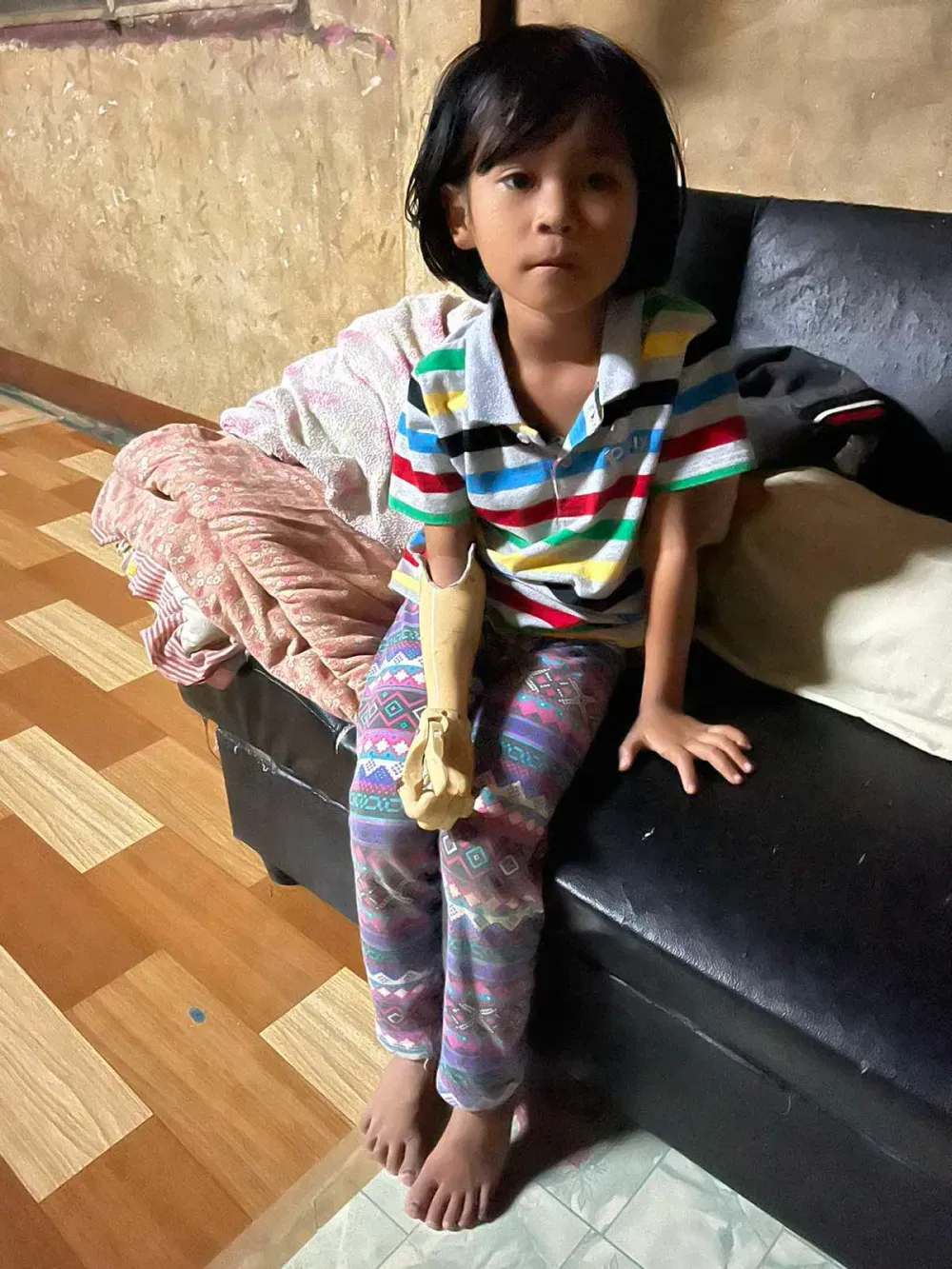 3D printed prosthetic-arm orthosis 10