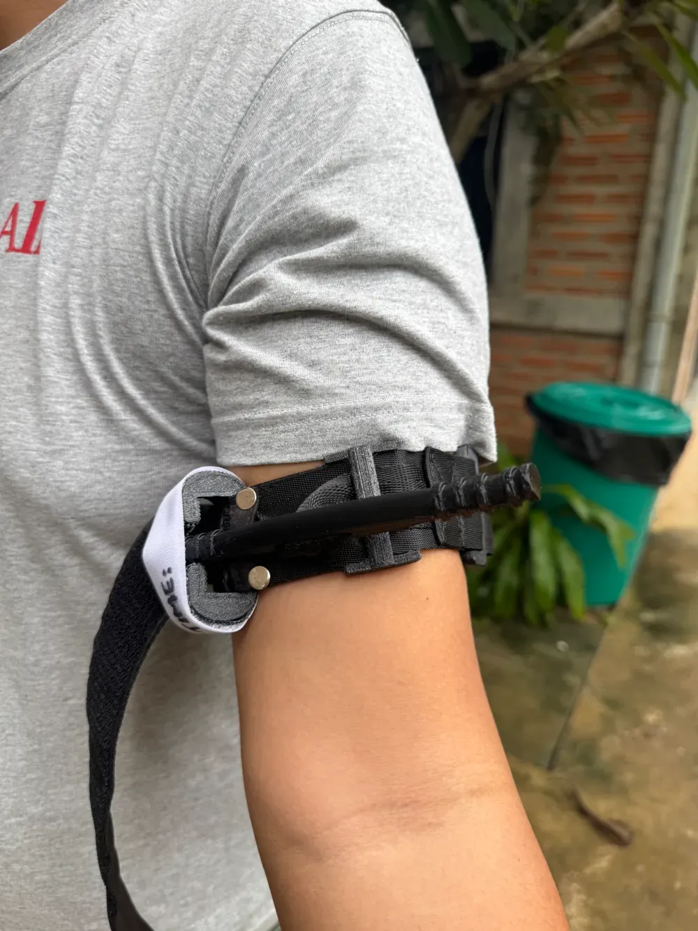 3D printed tourniquet orthosis 2