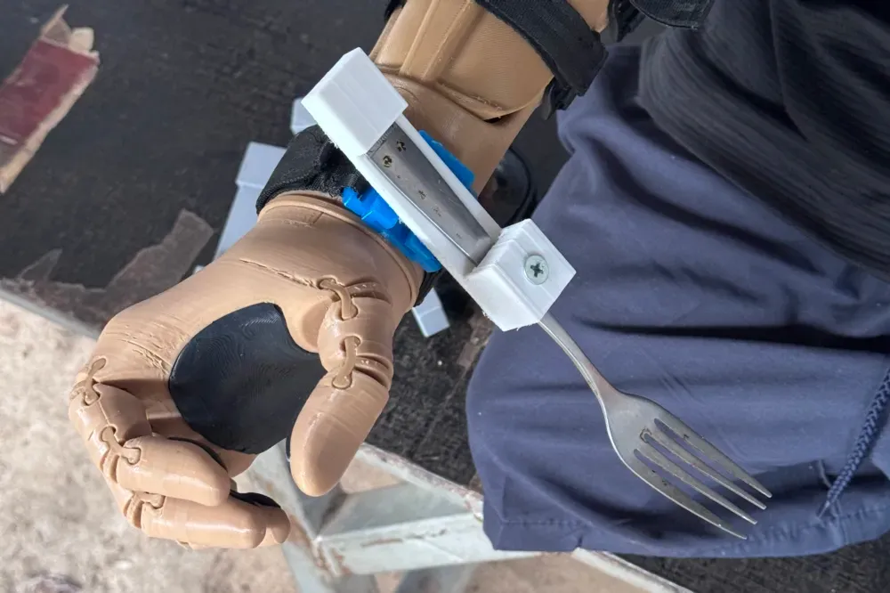3D printed utensil-holder orthosis 1