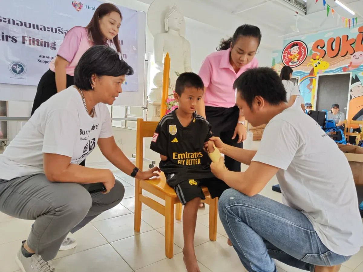 3D Prosthetics