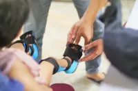 3D printed ankle-foot orthosis 2