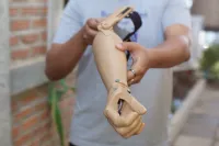 3D printed bcmf-gripper orthosis 4