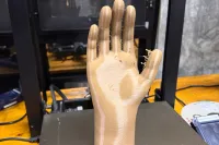 3D printed cosmetic-hand orthosis 1