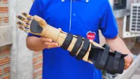 3D printed kinetic-hand orthosis 6
