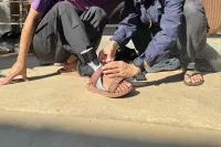 3D printed orthosis 1