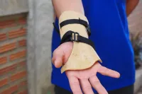 3D printed orthosis 4