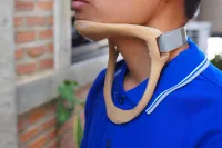 3D printed orthosis 5