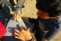 3D printed prosthetic-arm orthosis 3