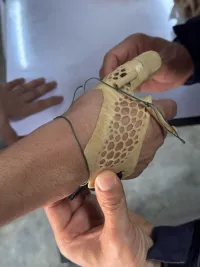 3D printed prosthetic-arm orthosis 4