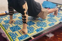 3D printed prosthetic-arm orthosis 7