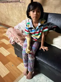 3D printed prosthetic-arm orthosis 10